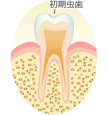 天然歯生体模倣の真髄 Dr.青島のダイレクトボンディング大全 新品日本